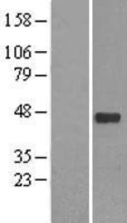 Novus Biologicals&trade;&nbsp;NeuroD1 Overexpression Lysate
