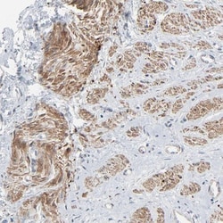 NeuroD1 Antibody, Novus Biologicals:Antibodies:Primary Antibodies