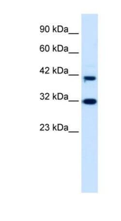 Neuro D4 Antibody, Novus Biologicals 100&mu;L; Unlabeled:Antibodies, Polyclonal