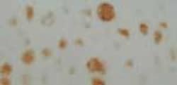 Neurofibromin 1 Antibody, Novus Biologicals 0.125mL; Unlabeled:Antibodies,