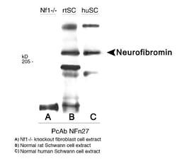 Neurofibromin 1 Antibody, Novus Biologicals 0.125mL; Unlabeled:Antibodies,