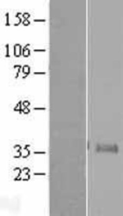 Novus Biologicals&trade;&nbsp;Neurogenin-1 Overexpression Lysate