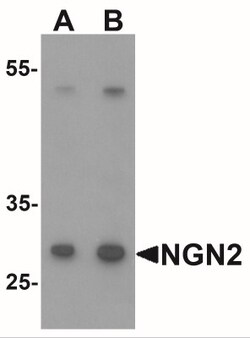 Neurogenin-2 Antibody - BSA Free, Novus Biologicals:Antibodies:Primary