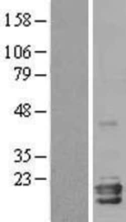 Novus Biologicals&trade;&nbsp;Neuroglobin Overexpression Lysate