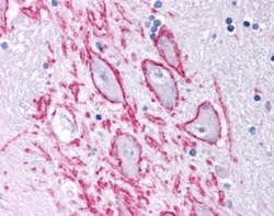 Novus Biologicals™ NK1R Antibody Pack