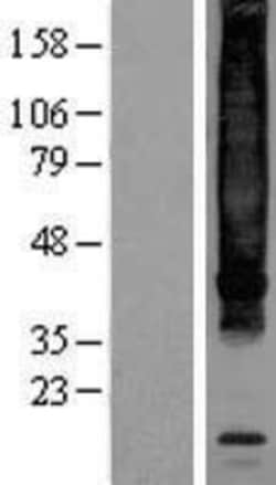 Novus Biologicals&trade;&nbsp;NK1R Overexpression Lysate