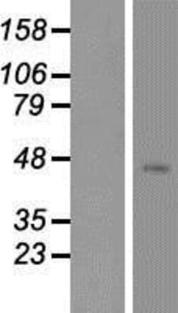 Novus Biologicals&trade;&nbsp;NK2R Overexpression Lysate