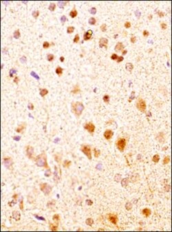 Neurokinin B Antibody - BSA Free, Novus Biologicals 0.025mL; Unlabeled:Antibodies,