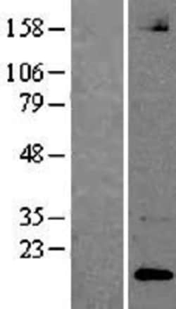 Novus Biologicals&trade;&nbsp;Neuroligin 1/NLGN1 Overexpression Lysate