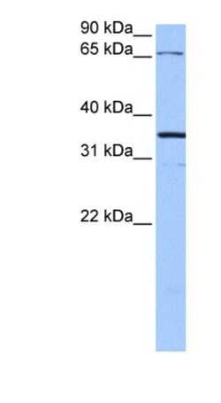 Neuroligin 4X/NLGN4X Antibody, Novus Biologicals:Antibodies:Primary Antibodies