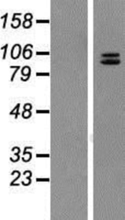 Novus Biologicals&trade;&nbsp;Neuroligin 4Y/NLGN4Y Overexpression Lysate