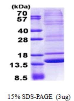Novus Biologicals&trade;&nbsp;Recombinant Human Neuromedin B His Protein