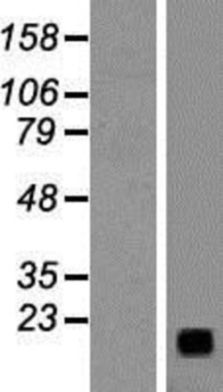 Novus Biologicals&trade;&nbsp;Gastrin-releasing Peptide/Bombesin/Neuromedin C Overexpression Lysate