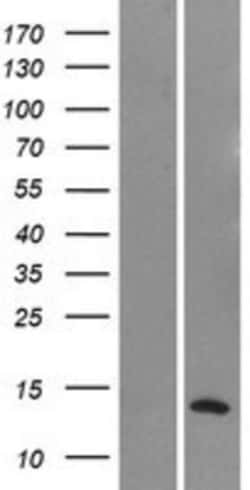 Novus Biologicals&trade;&nbsp;Neuromedin S Overexpression Lysate