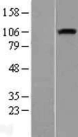 Novus Biologicals&trade;&nbsp;Neuropilin-1 Overexpression Lysate