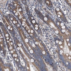 Neuropilin-1 Antibody, Novus Biologicals 0.1mL; Unlabeled:Antibodies, Polyclonal