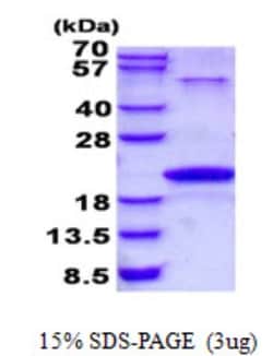 Novus Biologicals&trade;&nbsp;Recombinant Human Neurotensin His Protein