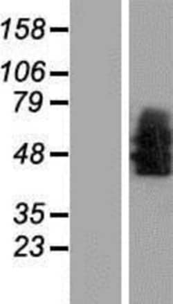 Novus Biologicals&trade;&nbsp;NTS1/NTSR1 Overexpression Lysate