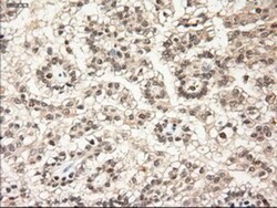 NT-3 Antibody (OTI5A2), Novus Biologicals 0.1mL; Unlabeled:Antibodies,