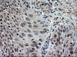 NT-3 Antibody (OTI5A2), Novus Biologicals 0.1mL; Unlabeled:Antibodies,