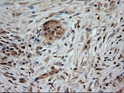 NT-3 Antibody (OTI5A2), Novus Biologicals 0.1mL; Unlabeled:Antibodies,