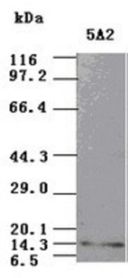 NT-3 Antibody (OTI5A2), Novus Biologicals 0.1mL; Unlabeled:Antibodies,