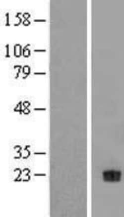 Novus Biologicals&trade;&nbsp;NT-4 Overexpression Lysate