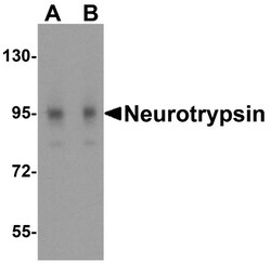 Neurotrypsin Antibody - BSA Free, Novus Biologicals 0.1mg; Unlabeled:Antibodies,