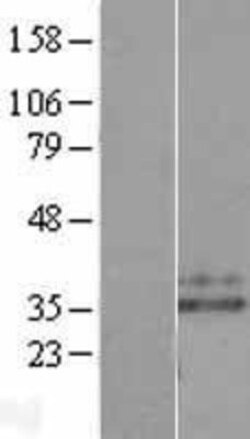 Novus Biologicals&trade;&nbsp;Neutrophil Elastase/ELA2 Overexpression Lysate