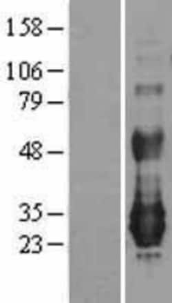 Novus Biologicals&trade;&nbsp;NFAM1 Overexpression Lysate