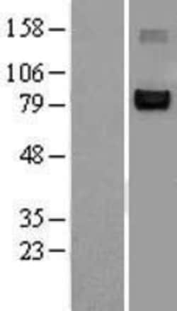 Novus Biologicals&trade;&nbsp;NFATC1/NFAT2 Overexpression Lysate