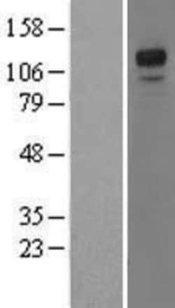 Novus Biologicals&trade;&nbsp;NFATC3/NFAT4 Overexpression Lysate