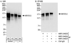NFATC3/NFAT4 Antibody, Novus Biologicals 0.1mg; Unlabeled:Antibodies, Polyclonal