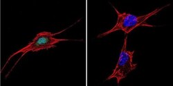 NFAT5 Antibody, Novus Biologicals 0.05mg; Unlabeled:Antibodies, Polyclonal