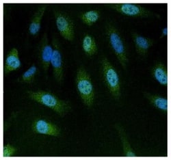 NFAT5 Antibody, Novus Biologicals 0.05mg; Unlabeled:Antibodies, Polyclonal