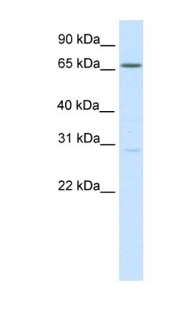 NFAT5 Antibody, Novus Biologicals 100 &mu;L | Buy Online | Novus Biologicals | Fisher Scientific