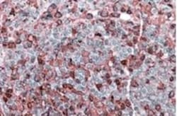 NFATC2/NFAT1 Antibody, Novus Biologicals 0.1mg; Unlabeled:Antibodies, Polyclonal