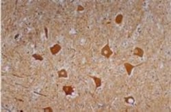NF-H Antibody (NF-01) - BSA Free, Novus Biologicals 0.1mg; Unlabeled:Antibodies,