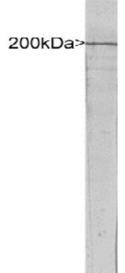 NF-H Antibody, Novus Biologicals 0.1 mL; Unconjugated:Antibodies, Polyclonal