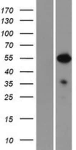 Novus Biologicals&trade;&nbsp;NFIA Overexpression Lysate