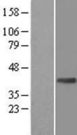 Novus Biologicals&trade;&nbsp;NFIL3 Overexpression Lysate