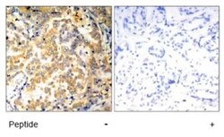 NFkB p100/p52 Antibody, Novus Biologicals 0.025 mL | Buy Online | Novus Biologicals | Fisher Scientific