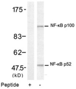 NFkB p100/p52 Antibody, Novus Biologicals 0.025 mL | Buy Online | Novus Biologicals | Fisher Scientific