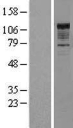 Novus Biologicals&trade;&nbsp;NFkB p105/p50 Overexpression Lysate