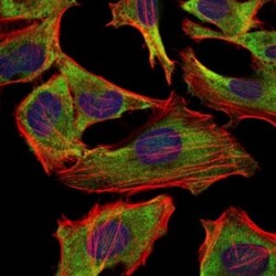 NF-L Antibody (1H3), Novus Biologicals:Antibodies:Primary Antibodies