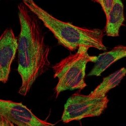 NF-L Antibody (2G10) - BSA Free, Novus Biologicals 0.1mL; Unlabeled:Antibodies,
