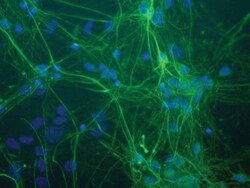 NF-L Antibody (DA2), Novus Biologicals:Antibodies:Primary Antibodies