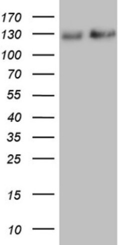 NF-M Antibody (OTI2G3), Novus Biologicals 0.1mL; Unlabeled:Antibodies,