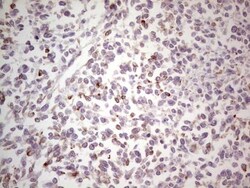 NF-M Antibody (OTI2G3), Novus Biologicals 0.1mL; Unlabeled:Antibodies,