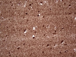 NF-M Antibody (OTI2G3), Novus Biologicals 0.1mL; Unlabeled:Antibodies,